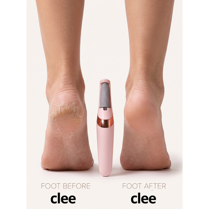 Clee™ Electric Callous Remover